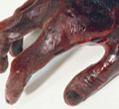 The Blood Hand